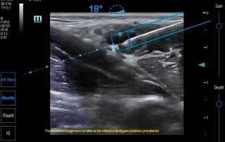Mindray Ultrasound TE7