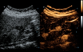 Mindray Ultrasound TE7