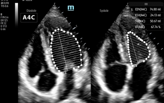 Mindray Ultrasound TE7