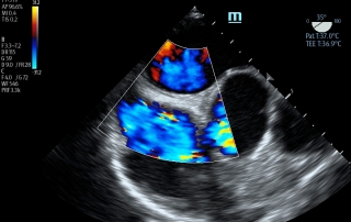 Mindray Ultrasound TE7