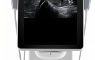 Mindray Ultrasound TE7