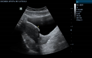 Mindray Ultrasound Z5