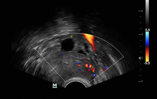 Mindray Ultrasound Z5
