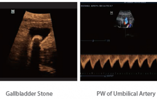 Mindray Ultrasound Z5