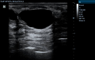 Mindray Ultrasound Z6
