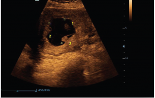 Mindray Ultrasound Z6
