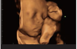 Mindray Ultrasound Z60