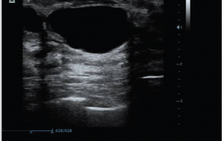 Mindray Ultrasound Z6