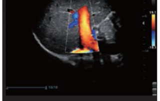 Mindray Ultrasound Z60