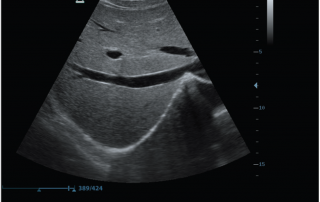 Mindray Ultrasound Z6
