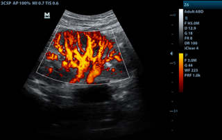 Mindray Ultrasound Z6