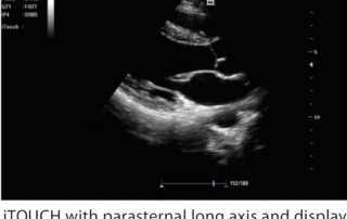 Mindray Ultrasound M7
