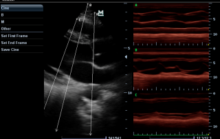 Mindray Ultrasound M7 Premium