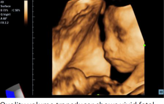 Mindray Ultrasound M7