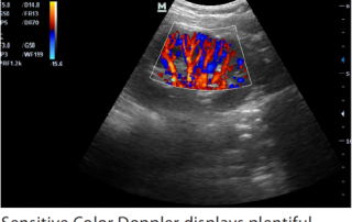 Mindray Ultrasound M7