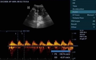 Mindray Ultrasound DP-20