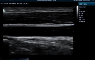 Mindray Ultrasound DP-20