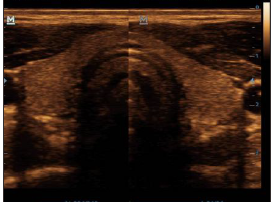 Mindray Ultrasound DP-20