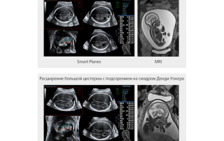 Mindray Ultrasound Resona 6