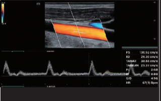 Mindray Ultrasound MX7