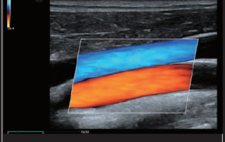 Mindray Ultrasound MX7