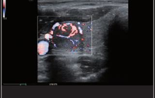 Mindray Ultrasound MX7