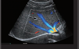 Mindray Ultrasound MX7