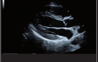 Mindray Ultrasound MX7