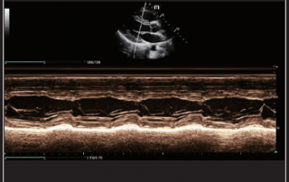 Mindray Ultrasound MX7