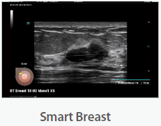 Mindray Ultrasound Consona N9