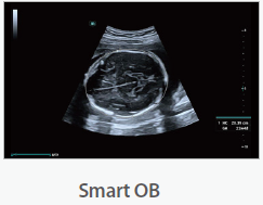 Mindray Ultrasound Consona N9