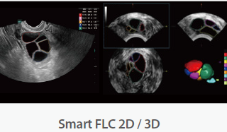 Mindray Ultrasound Consona N9