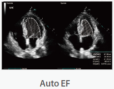 Mindray Ultrasound Consona N9