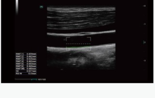 Mindray Ultrasound Consona N9