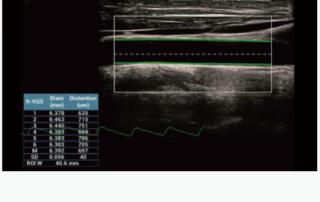 Mindray Ultrasound Consona N9