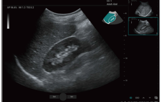 Mindray Ultrasound Consona N9