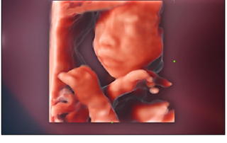 Mindray Ultrasound Consona N9