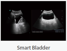Mindray Ultrasound Consona N9