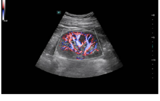 Mindray Ultrasound Consona N9
