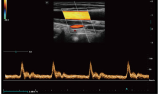 Mindray Ultrasound Consona N9