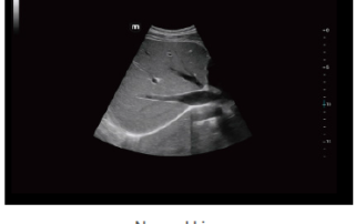 Mindray Ultrasound Consona N9