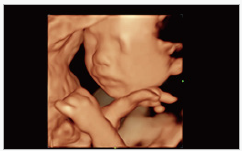 Mindray Ultrasound Consona N9