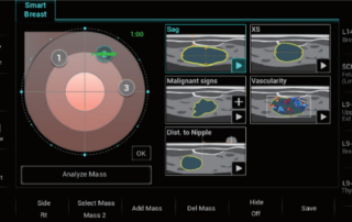 Mindray Resona I9