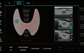 Mindray Resona I9