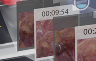 Mindray HyPixel™ U1 Endoscope